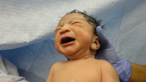 weinendes Neugeborenes nach Kaiserschnitt